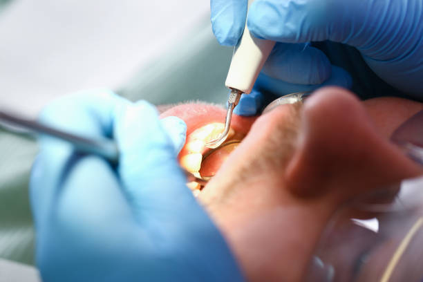 Best Urgent Dental Care for Toothache in Port Sulphur, LA